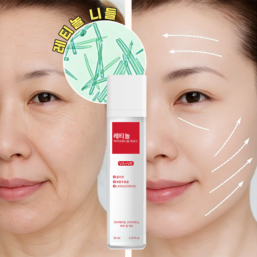 호주주름크림옥순 추천 5개 인기 필수 제품 지금 바로 만나보세요!